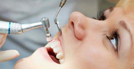 Piaskowanie zębów – najważniejsze informacje