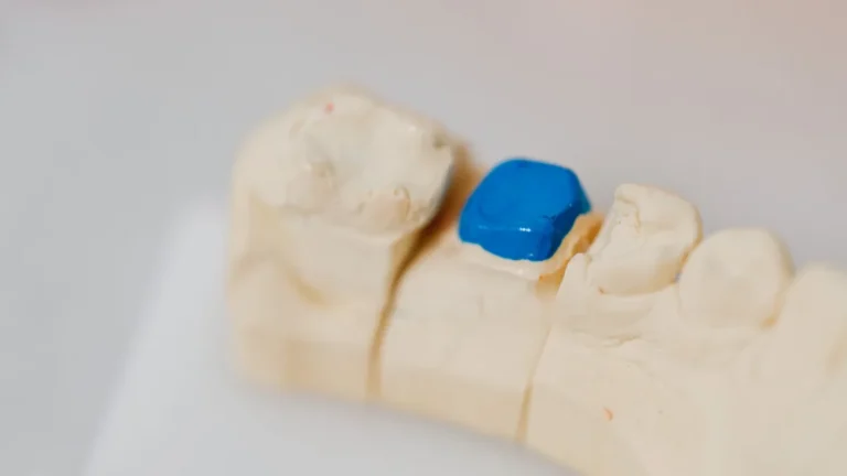 Close-up of a dental jaw model with a blue filling, showcasing dental anatomy and dentistry tools.