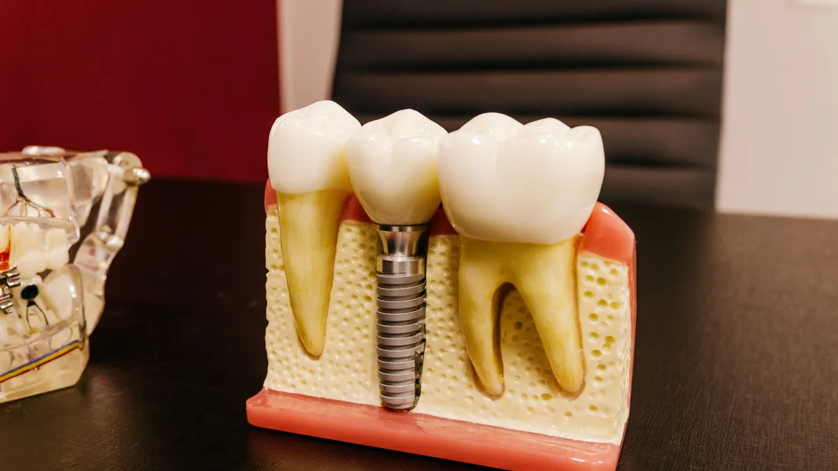 Ceramic dental implants with bolt in artificial mouth piece on desktop in hospital