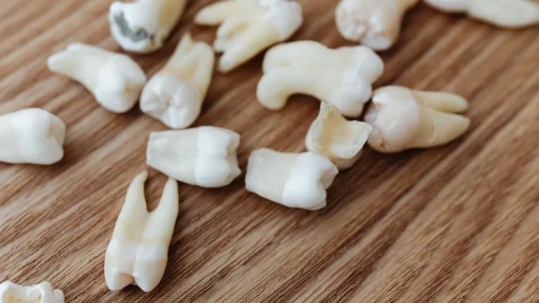 A detailed close-up of multiple extracted human teeth arranged on a wooden background surface.