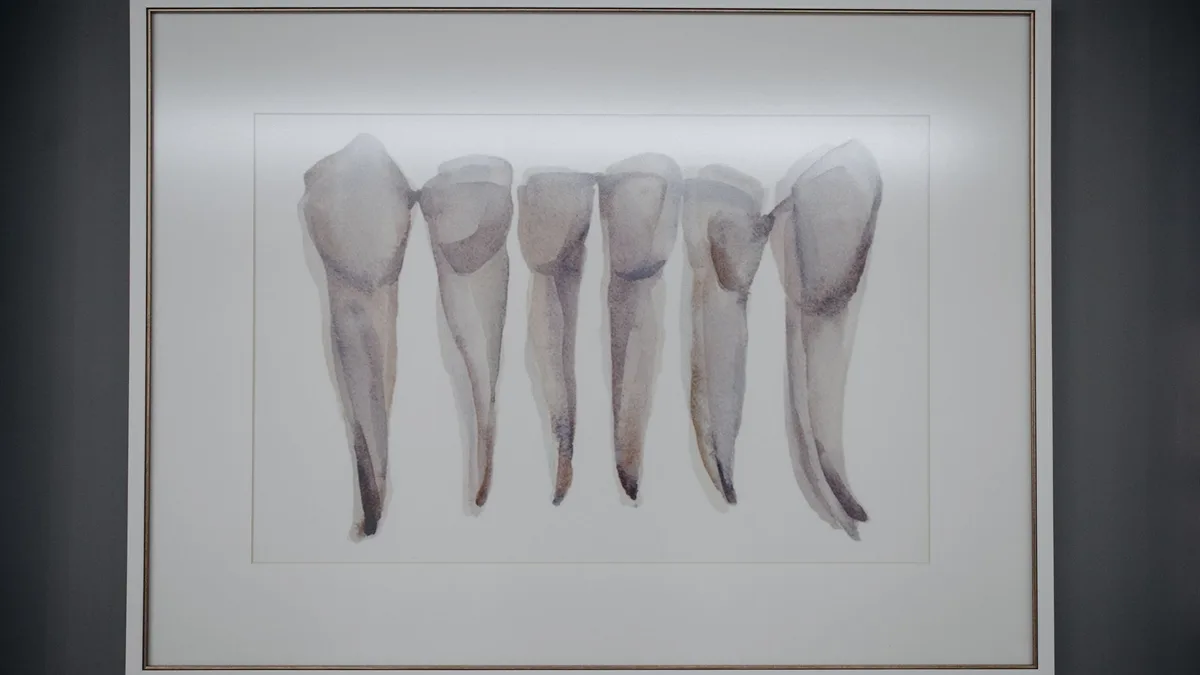Artistic depiction of extracted teeth framed and displayed in a dental clinic.