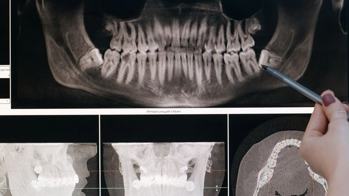 Detailed dental X-ray showing teeth structure highlighted by a pointing pen.