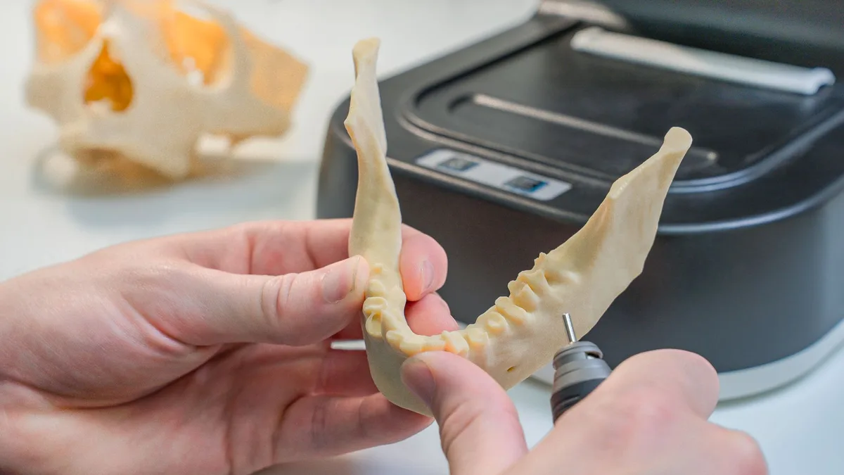 Detailed view of a 3D printed dental model being refined by a technician in a laboratory.